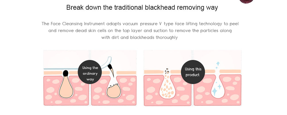Electric Acne Blackhead Remover Skin Vacuum